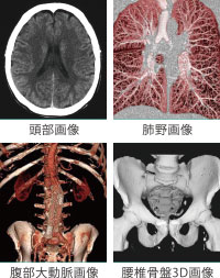 CT検査結果